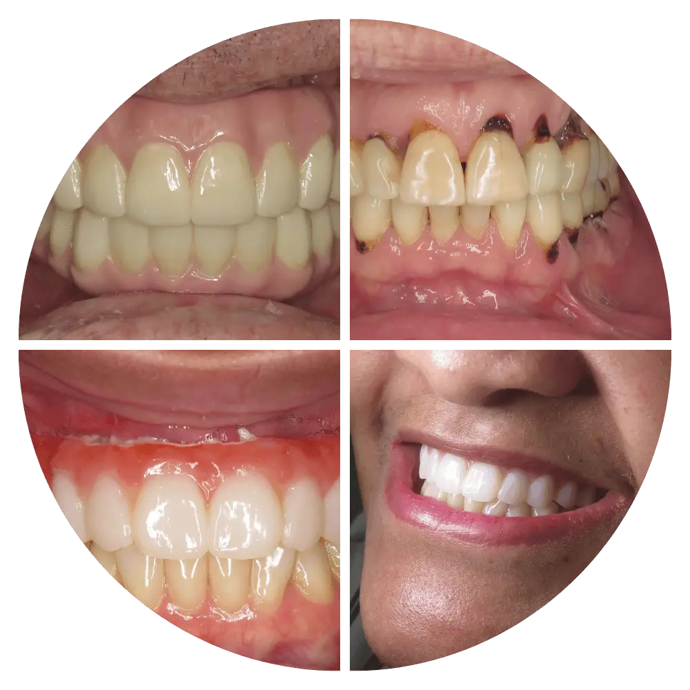 promotional-dental